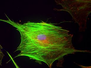 Immunofluorescence stained cell